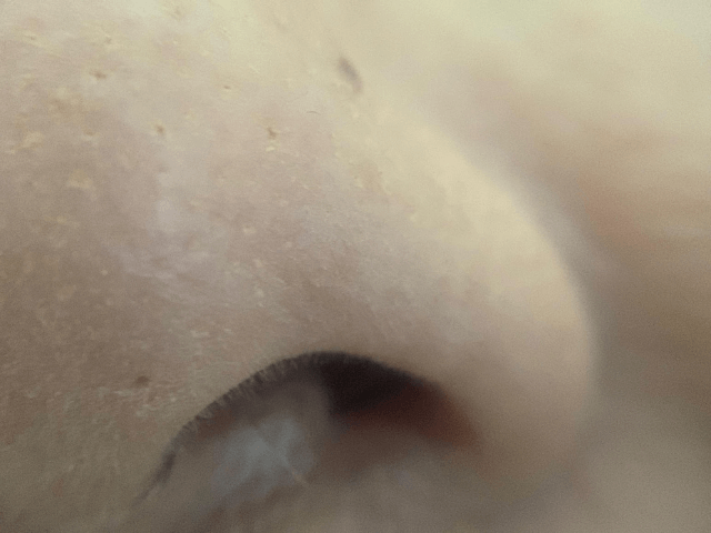 face-skin-pores